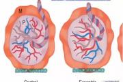 什么是“乒乓球拍胎盘”？ 危险吗？如何用彩超来监控？